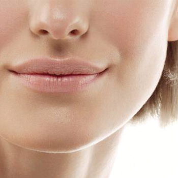 Marionette lines treatment